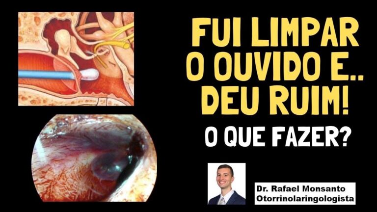 Evite les&otilde;es: Cuidados ao usar cotonetes no ouvido