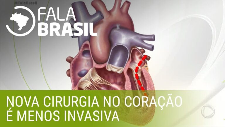 Cirurgia na Valva Cardíaca: Tudo o que Precisa Saber