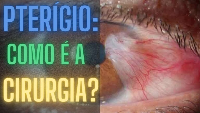Raspagem no olho: por que dói e como aliviar