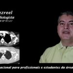 Discopatia Degenerativa Cervical C5-C6: Causas, Sintomas e Tratamentos