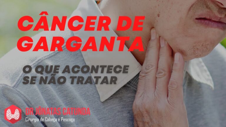 Custo da cirurgia de c&acirc;ncer na garganta: tudo o que voc&ecirc; precisa saber
