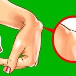 Veias da Virilha: O Que Voc&ecirc; Precisa Saber
