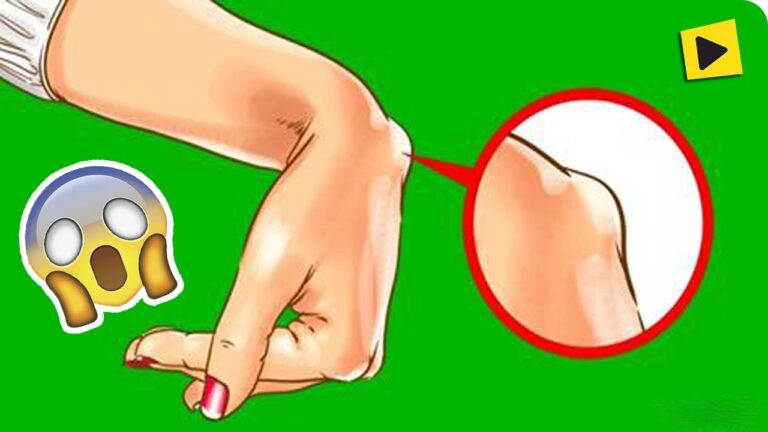 Osso da Mão Saltado: Causas, Sintomas e Tratamento