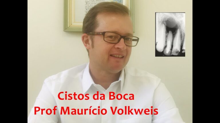 Cistos Bucais: Causas, Sintomas e Tratamentos