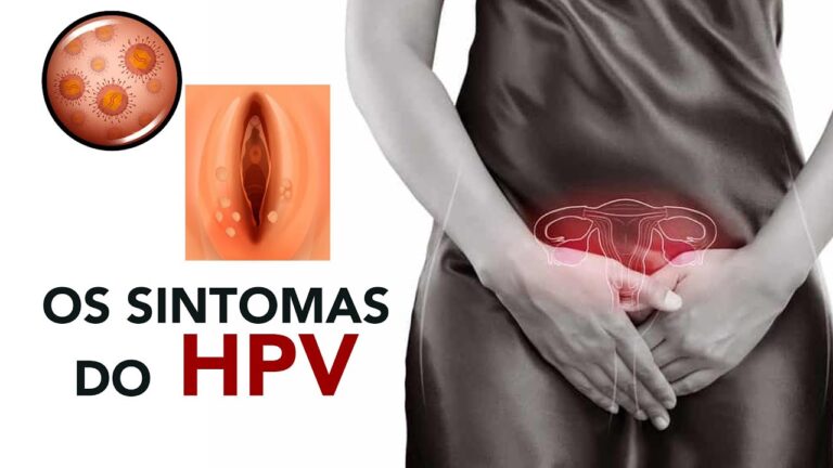 Tipos de HPV: Fotos