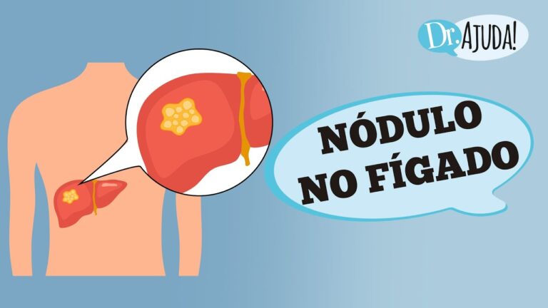 Como identificar se um nódulo no fígado é maligno