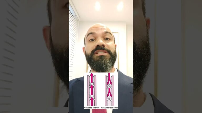Tratamento eficaz para varizes no braço