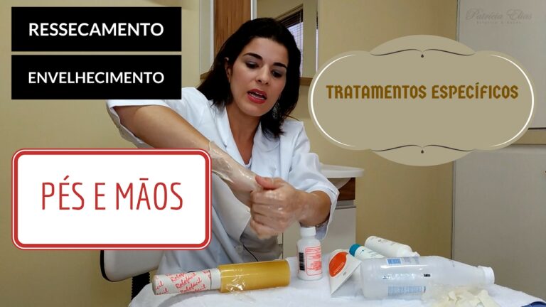 Como Tratar Rachaduras nas M&atilde;os: Guia Completo
