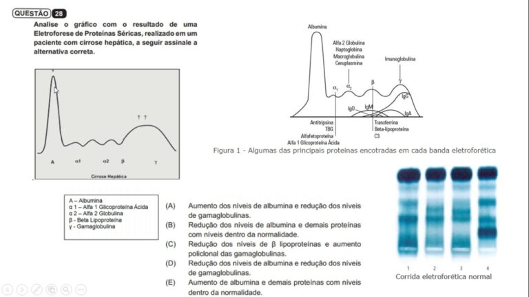 Valores de refer&ecirc;ncia na eletroforese de prote&iacute;nas