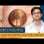 Ginecomastia em Mulheres: Causas, Sintomas e Tratamentos