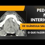 Cirurgia de Tendão na Mão: Tudo o Que Você Precisa Saber