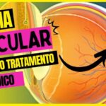 Como Aliviar Coceira no Ouvido por Dentro