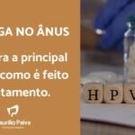 Como identificar varizes: 5 sinais que não pode ignorar