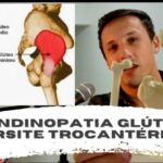 N&oacute;dulo n&atilde;o calcificado no pulm&atilde;o: diagn&oacute;stico e tratamento