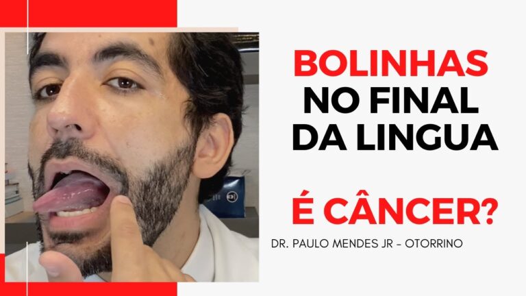 Como lidar com bolinhas na língua das crianças