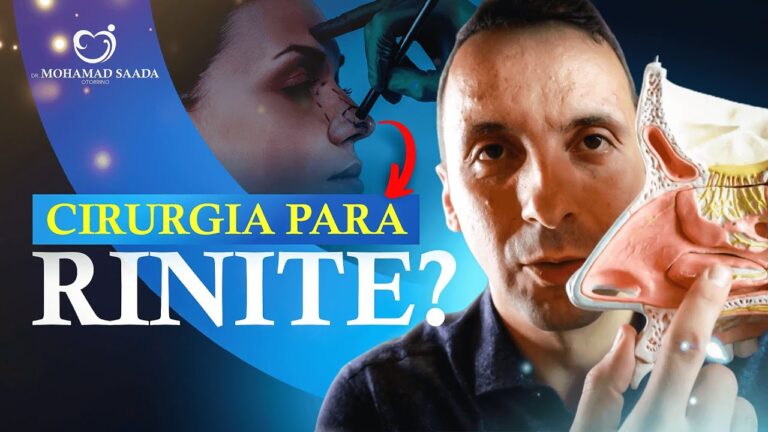 Benefícios da Cirurgia para Rinite Alérgica