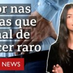 Colocar gelo na coluna cervical: é seguro?