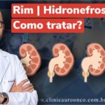 Como prevenir e tratar o SBP em bovinos: mata carrapato