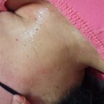 Dor Intensa no Ânus: Causas e Tratamentos