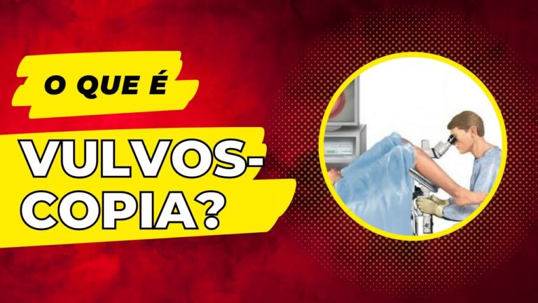 Vulvoscopia: Mitos e Verdades sobre o Procedimento que Causa Dor