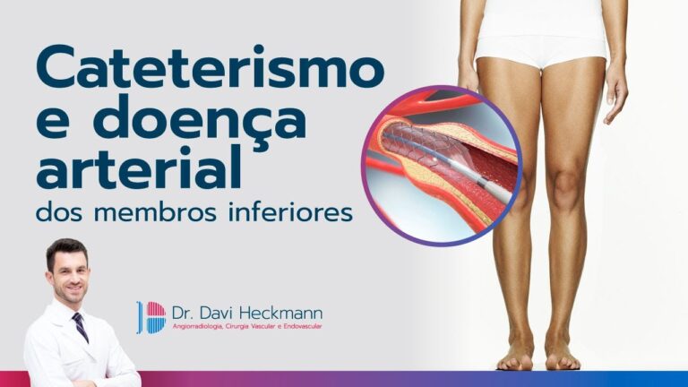 Cirurgia de desobstrução da veia da perna: eficácia e cuidados