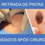 Dose ideal de metotrexato para artrite reumatoide: um guia abrangente