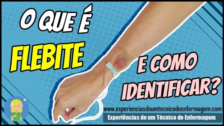 Veia da Mão Inchada e Dolorida: Causas e Tratamentos