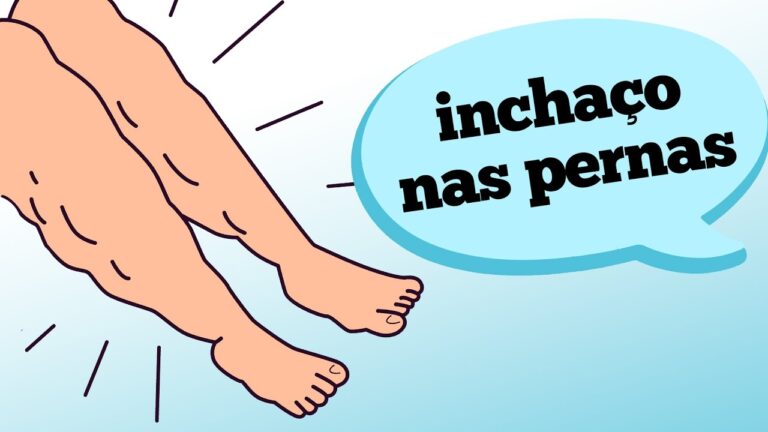 Pernas Inchadas: Causas e Tratamentos | Actualizado marzo 2026