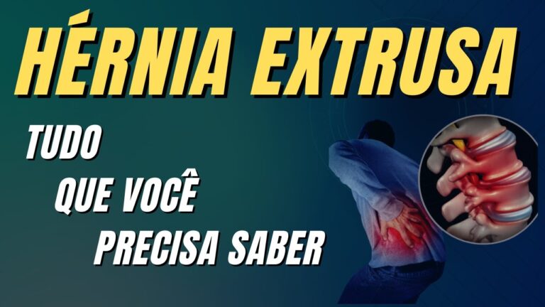 Hérnia de disco extrusa: tratamentos e possibilidades de cura