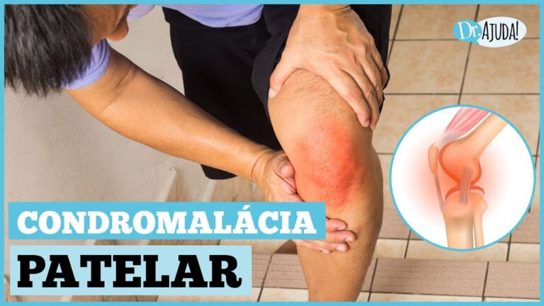 Condropatia: Entenda o que é e como tratar