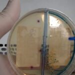 Como Calcular a Dose de Predsim em Gotas