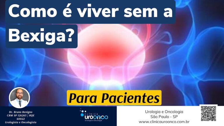 Retirada da Bexiga Feminina: Tudo o que Precisa Saber