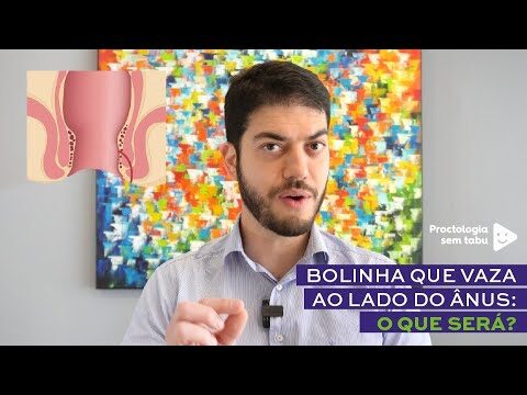 Como Tratar Bolinhas na Região Anal: Guia Completo