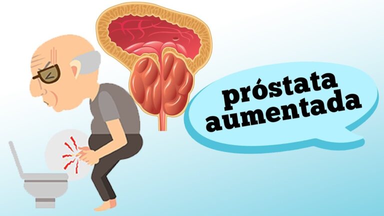 Tudo sobre a Próstata Aumentada: Causas, Sintomas e Tratamentos