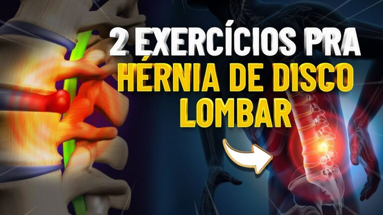 Exercícios ideais para hernia de disco: guia completo