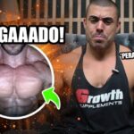 Discopatia Degenerativa Cervical C5-C6: Causas, Sintomas e Tratamentos
