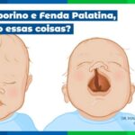 Como identificar varizes: 5 sinais que não pode ignorar