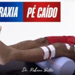 Dose ideal de metotrexato para artrite reumatoide: um guia abrangente