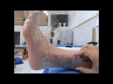 Recuperação eficaz: Fisioterapia para tornozelo quebrado