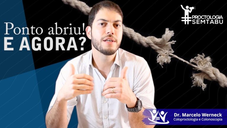 Tempo de Recupera&ccedil;&atilde;o da Cirurgia de Hemorroidas: Quantos Dias at&eacute; os Pontos Ca&iacute;rem?