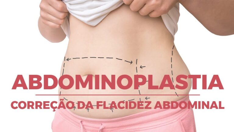 Nomes de Cirurgias na Barriga: Guia Completo