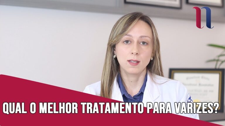 Como tratar varizes calibrosas: guia completo
