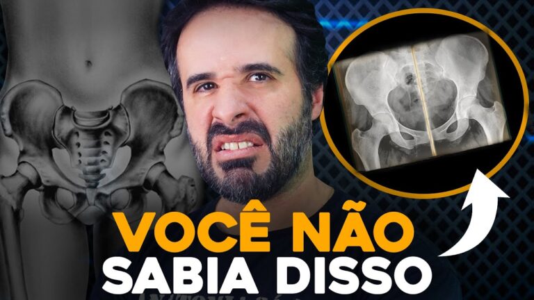 Fratura no púbis em mulheres: Causas, Sintomas e Tratamento
