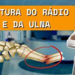 Fratura de nariz: Como identificar e tratar