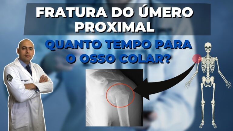 Tempo de recuperação para fratura de úmero