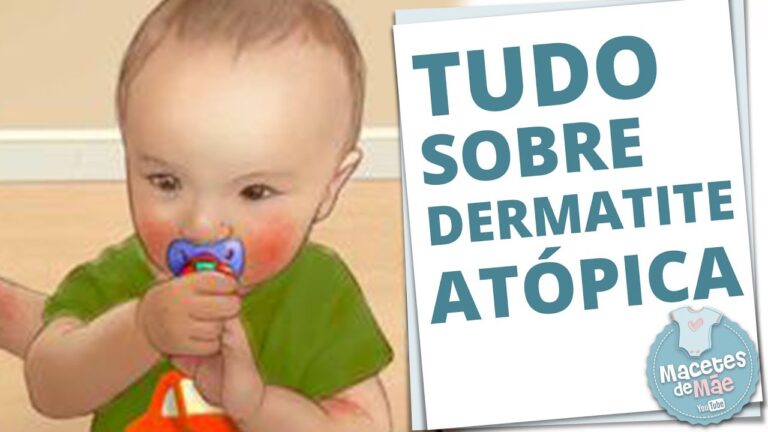 Umidita Infantil na Prevenção da Dermatite: Guia Completo