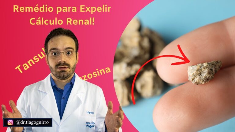 Como expelir cálculos renais de forma eficaz