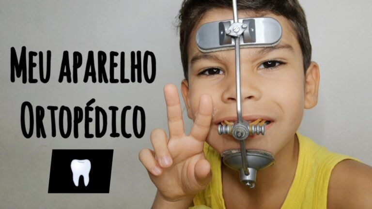 Dispositivo de avanço da mandíbula: O que você precisa saber