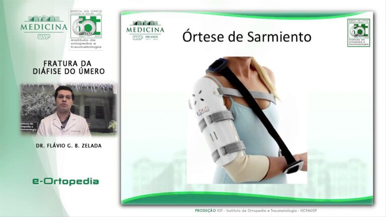 Anatomia e Função da Diáfise do Úmero