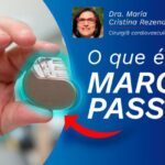 Como identificar varizes: 5 sinais que não pode ignorar
